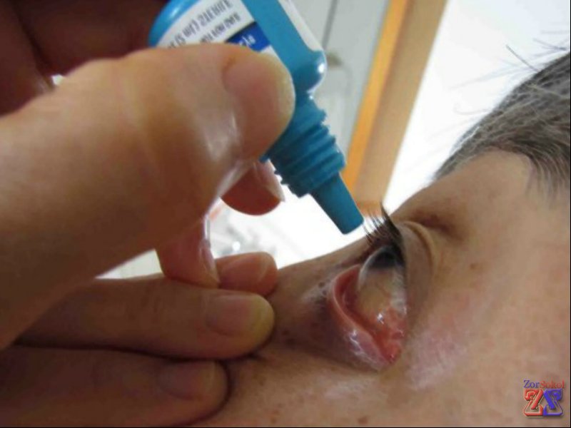 Показания - инфекционные воспаления глаз Показания - инфекционные воспаления глаз