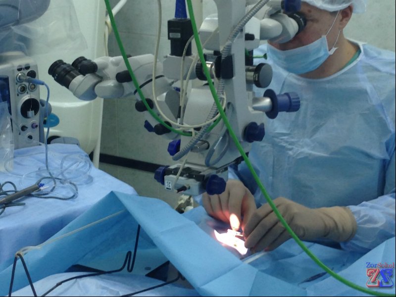 Торической может быть и ИОЛ Торической может быть и ИОЛ