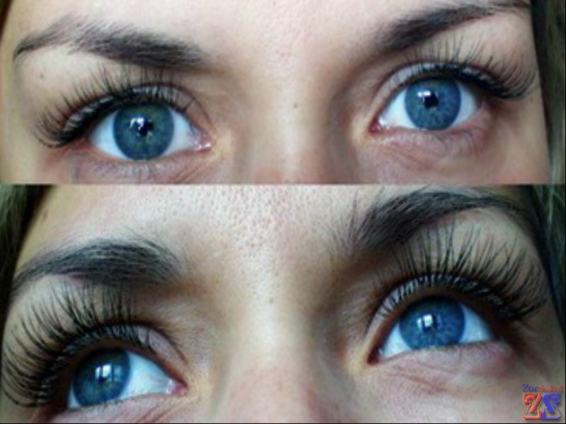 Одно из побочных действий Траватана: улучшение роста ресниц Одно из побочных действий Траватана: улучшение роста ресниц