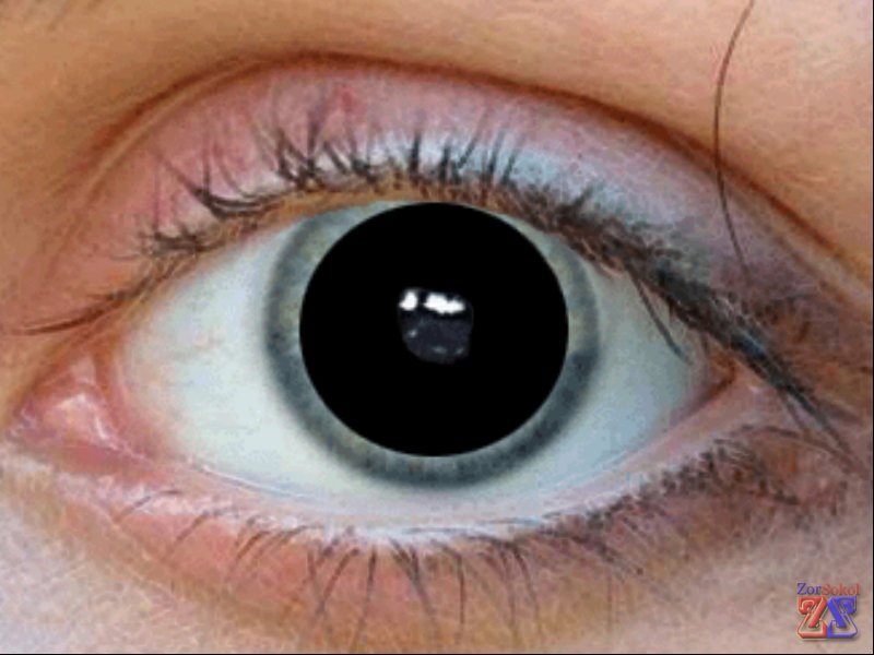 Используется для расширения зрачка Используется для расширения зрачка