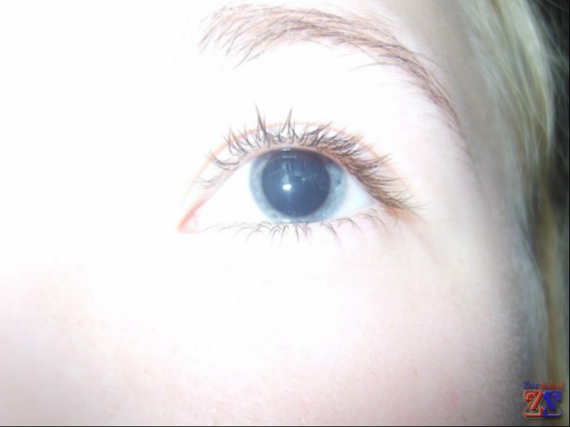 Расширения зрачка для осмотра глазного дна Расширения зрачка для осмотра глазного дна