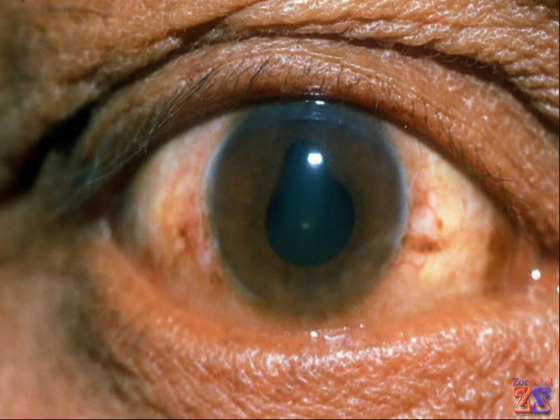 Воспаления возникают по разным причинам Воспаления возникают по разным причинам