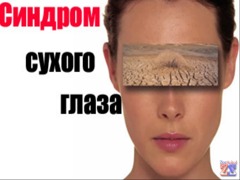 Основное показание - синдром сухого глаза Основное показание - синдром сухого глаза