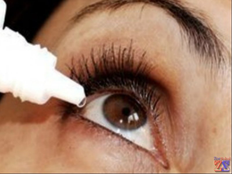 Показание - умеренное раздражение глаз Показание - умеренное раздражение глаз