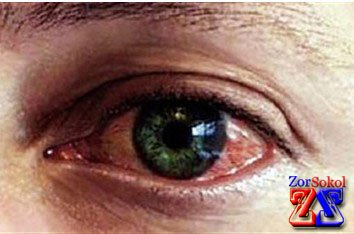 В первую очередь нужно найти причину заболевания В первую очередь нужно найти причину заболевания