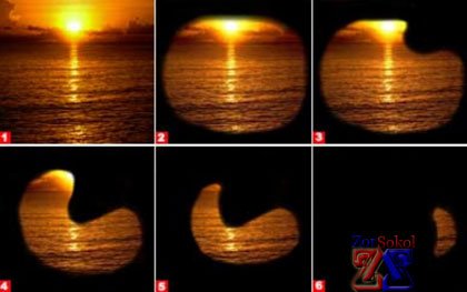 Как происходит потеря зрения Как происходит потеря зрения